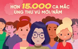 100 suất khám miễn phí u xơ tuyến vú