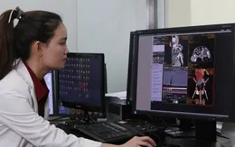 Nữ bác sĩ "dẫn đường hình ảnh" cho cuộc đại phẫu tách dính Song Nhi