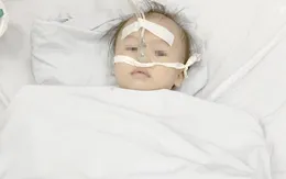 Bé 1 tuổi nguy kịch vì hóc... chôm chôm
