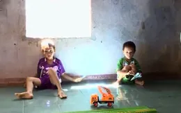 Nhiều hệ lụy khi trẻ bị suy dinh dưỡng cấp tính
