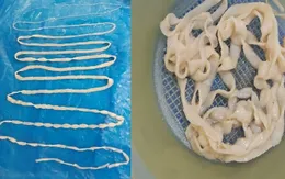 Thường xuyên ăn bò tái, bò nhúng người đàn ông xổ ra con sán dây dài 3m
