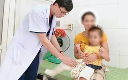 Phẫu thuật trật khớp háng bẩm sinh hiếm gặp