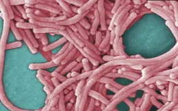 Phát hiện vi khuẩn legionella trong đường ống nước của văn phòng CDC Mỹ