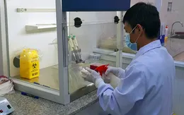 Tăng cường năng lực xét nghiệm Realtime RT-PCR phát hiện SARS-CoV-2 tại các bệnh viện