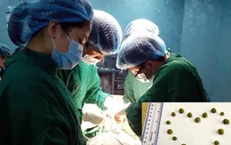 Lấy 16 viên sỏi ra khỏi bàng quang người đàn ông