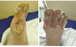Vung câu vào dây điện, người đàn ông nguy kịch