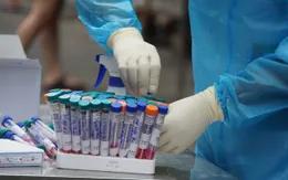 Công suất xét nghiệm SARS-CoV-2 của Việt Nam được nâng lên rõ rệt