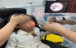 Gắp con tặc còn sống trong mũi hai bệnh nhi