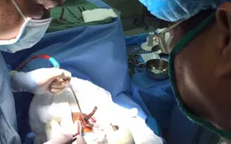 Ngã trong khi dắt xe đạp qua cầu, người đàn ông bị thanh sắt đâm xuyên sọ