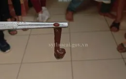 Gắp con nấc dài 6cm trong mũi bé trai vùng cao