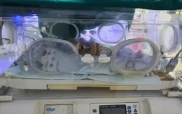 Sinh tại nhà, bé sơ sinh nguy kịch do mắc uốn ván