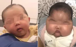 Trung Quốc thu hồi loại kem khiến trẻ nhỏ tăng cân bất thường