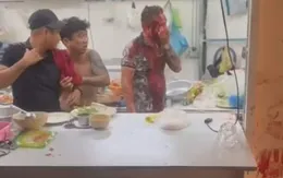 TP Hồ Chí Minh: Hỗn chiến trong quán nhậu, nhiều người bị thương