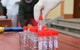 Hải Dương triển khai xét nghiệm SARS-CoV-2 trên diện rộng