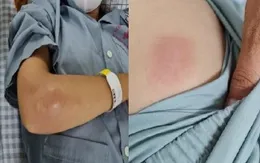 Cứu sống nữ bệnh nhân mắc bệnh Whitmore