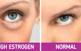 8 phương pháp đơn giản “đánh bay” tình trạng sưng mặt, sưng bọng mắt