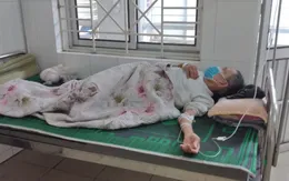 Bệnh nhân đái tháo đường gặp biến chứng do không tuân thủ điều trị