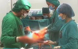 Cấp cứu kịp thời bệnh nhân bị sốc mất máu do cây gỗ đập vào bụng