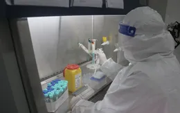 Trả kết quả xét nghiệm RT-PCR không vượt quá 24 giờ tính từ thời điểm lấy mẫu