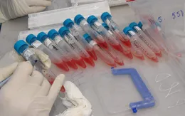 Thành phố Hải Dương đề xuất tiến hành xét nghiệm SARS-CoV-2 diện rộng trên toàn địa bàn