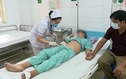 Học chế pháo trên mạng, bé 14 tuổi bị pháo nổ tổn thương bụng