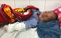 Thêm nhiều ca thương tích nặng do pháo nổ