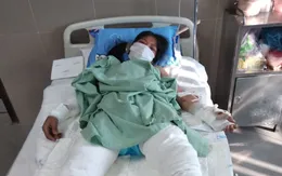 Kêu gọi giúp đỡ người phụ nữ bỏng toàn thân do chồng say rượu đổ xăng đốt