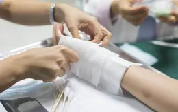 Xử lý phù nề, vết bầm do chấn thương phần mềm khi va chạm giao thông