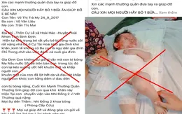Cảnh báo thông tin sai sự thật kêu gọi giúp đỡ bệnh nhi bị bỏng nặng