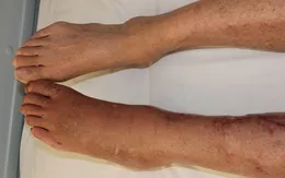 Những nguy cơ tiềm ẩn dễ nhầm lẫn của đau xương khớp