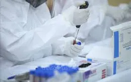 138 mẫu bệnh phẩm trên địa bàn tỉnh Bình Định đều cho kết quả âm tính với SARS-CoV-2