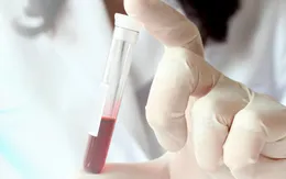 Phương pháp chẩn đoán nhiều bệnh từ xét nghiệm máu