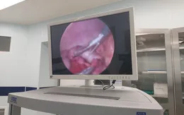Bé 10 tháng tuổi nhập viện vì 2 đoạn ruột lồng vào nhau