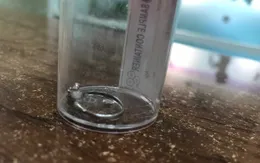 Lấy chiếc nhẫn trong dạ dày bé 3 tuổi