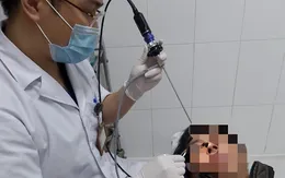 Đỉa vào sống ký sinh trong mũi người đàn ông sau khi uống nước suối