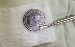 Cấp cứu bé 5 tuổi bị đồng xu mắc kẹt ở thực quản