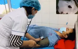 Nội soi khí quản gắp con đỉa suối sống trong mũi bệnh nhân 1 tháng
