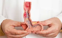 Cẩn trọng với nguy cơ ung thư dương vật