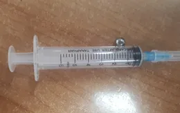 Bé trai nhập viện vì nhét bi sắt vào tai