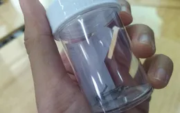 Mở lồng ngực cứu bé trai bị móc dây kéo lọt vào phế quản