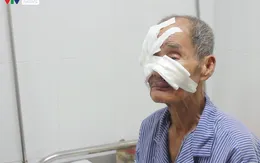 Mùa nóng đến gần, cẩn trọng nguy cơ ung thư da
