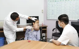 Cô gái trẻ bị biến dạng khuôn mặt vì khối u khổng lồ