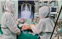 Trẻ nhập viện cấp cứu sau khi nuốt chìa khóa