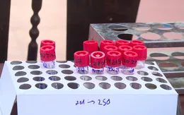 Trưa 11/8, Hà Nội có thêm 25 ca dương tính với SARS-CoV-2