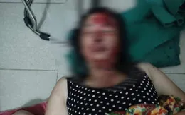 Điều tra việc vợ tố bị chồng dí điện, dìm xuống ao