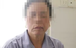 Người phụ nữ bị méo miệng, mắt không nhắm được do tắm muộn