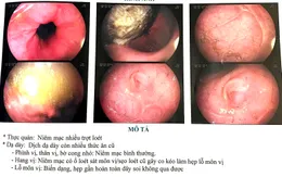 Bé 5 tuổi uống nhầm axit của bình ắc quy