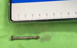 Cứu cụ ông 70 tuổi tự đóng đinh vào đầu vì trầm cảm
