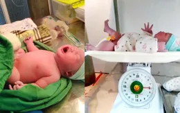 Bé trai sơ sinh chào đời với cân nặng 5kg