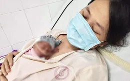 Điều trị kéo dài tuổi thai thành công cho sản phụ dọa sinh non ở tuần thai 24